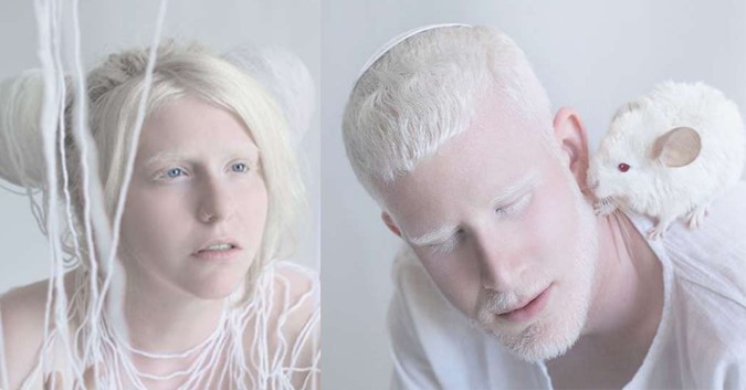 Màu tóc và da của bệnh nhân bị bệnh bạch tạng